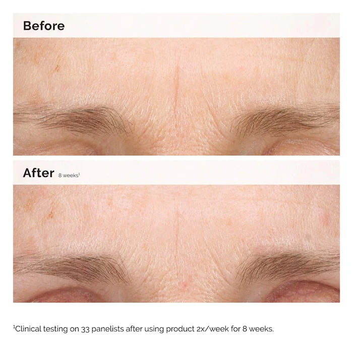 Retinal 0.2% Emulsion The Ordinary